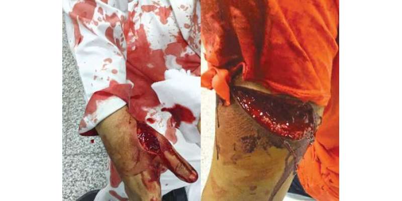 کویتی پولیس اہلکار اشتہاری کے حملے میں شدید زخمی