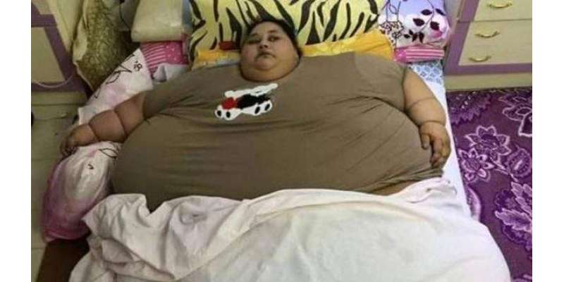 36 سالہ مصری خاتون ایمان احمد دنیا کی سب سے زیادہ وزن رکھنے والی خاتون، ..