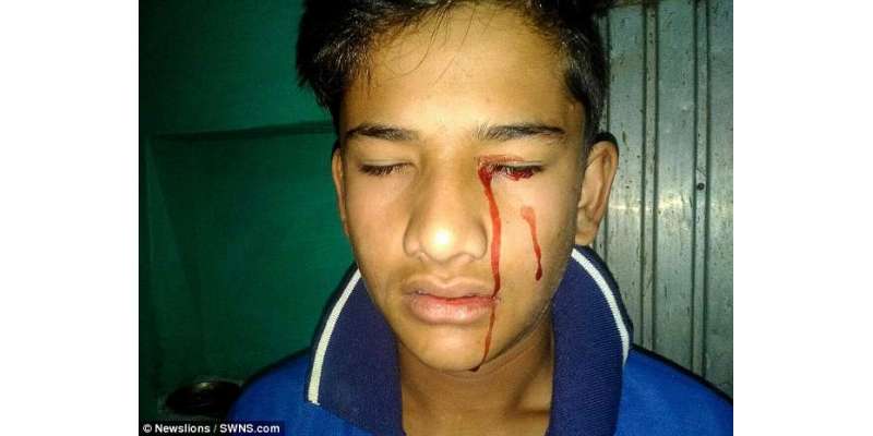 بھارتی نوجوان لڑکا حقیقت میں خون کے آنسو روتا ہے۔ دن میں دس بار کانوں، ..