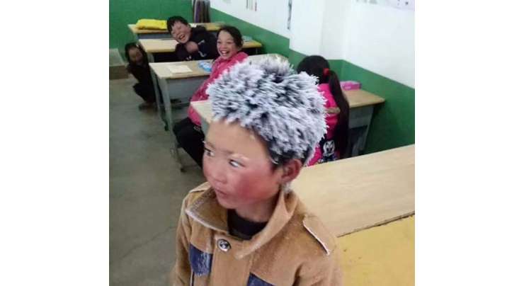 فلاحی  ادارےنے منجمد  بالوں والے لڑکے کی مدد کے لیے جمع ہونے والے 5 لاکھ یوان اسے دینےکی بجائے صرف8 ہزار یوان  پر ٹرخا دیا