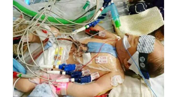 برطانیہ، ایک دن کے بچے کی دل کے دورے کے بعد اوپن ہارٹ سرجری