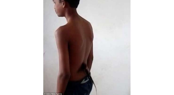 بھارتی ہندو 13 سالہ ”دُم دار“ مسلمان لڑکے کو ہنومان  کا دوسرا جنم سمجھنے لگے