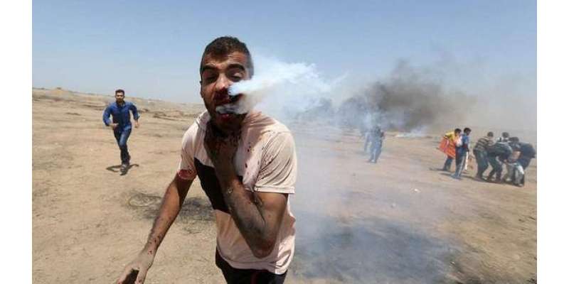 اسرائیلی فوج کا آنسو گیس کا شیل فلسطینی نوجوان کے چہرے پر پھٹ گیا
