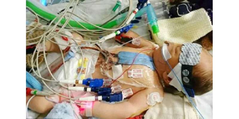 برطانیہ، ایک دن کے بچے کی دل کے دورے کے بعد اوپن ہارٹ سرجری