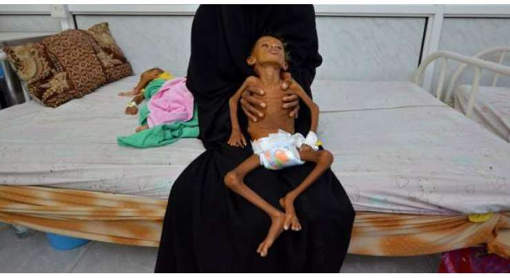 رواں برس کے آخر تک دس ملین یمنی موت کے منہ میں چلے جائیں گے