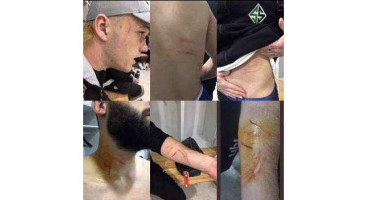 ترک کھلاڑی نے فٹ بال میچ کے دوران  پوشیدہ بلیڈ سے مخالف کھلاڑیوں کو زخمی کر دیا