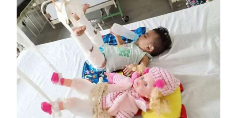 11 ماہ کی بچی کے فریکچر  کا علاج کرنے کے لیے ڈاکٹروں کو پہلے اس کی گڑیا ..