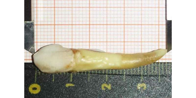 گینیز ورلڈ ریکارڈ نے 1.46 انچ کے دانت کو دنیا کا سب سے بڑا دانت قرار دے ..