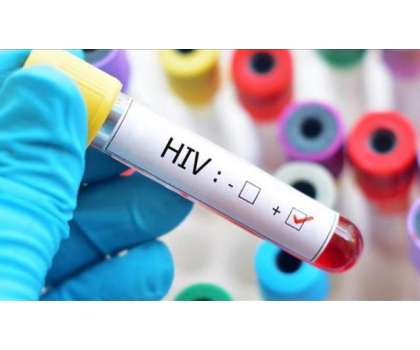 ایچ آئی وی ایڈز کے عالمی دن کی مناسبت سے آگہی سیمینارکا انعقاد