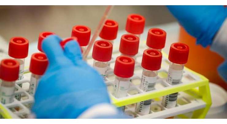 پنجاب یونیورسٹی کے سائنسدانوں نے کرونا وائرس کی تشخیص کے لئے سستی کٹ تیار کر لی
