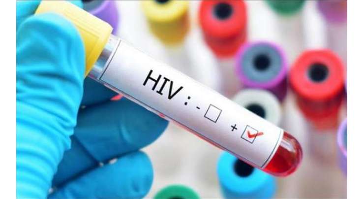 ایچ آئی وی ایڈز کے عالمی دن کی مناسبت سے آگہی سیمینارکا انعقاد