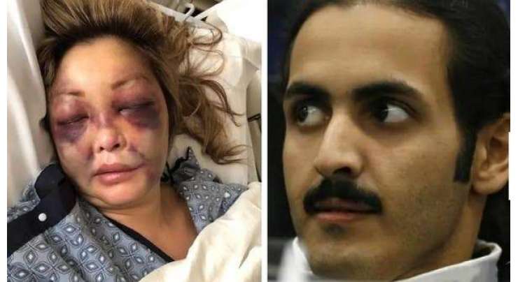 امیر قطر کے بھائی نے شاہی ڈاکٹر کی گرل فرینڈ پر جنسی حملہ کروا دیا