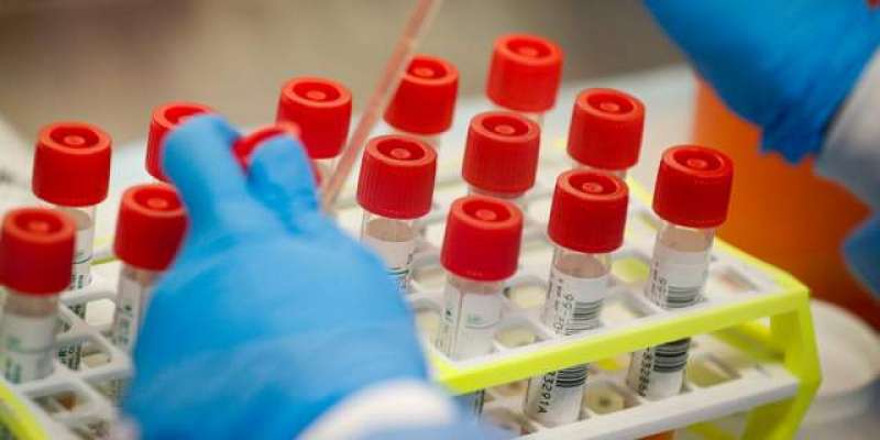 پنجاب یونیورسٹی کے سائنسدانوں نے کرونا وائرس کی تشخیص کے لئے سستی کٹ ..