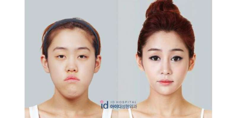 جنوبی کوریا  کے متنازعہ رئیلٹی شو میں پلاسٹک سرجری سے لڑکیوں کا چہرہ ..