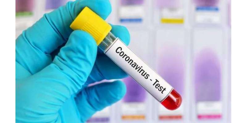 مانسہرہ میں چار افراد میں مزید کورونا وائرس کی تصدیق ہو گئی، متاثرہ ..