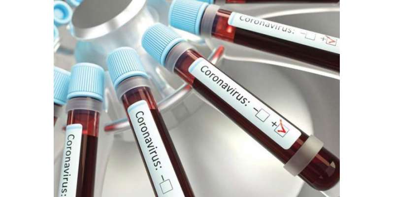 پاکستان، کورونا وائرس ٹیسٹ مثبت آنے کی شرح 4 فیصد سے اوپر چلی گئی