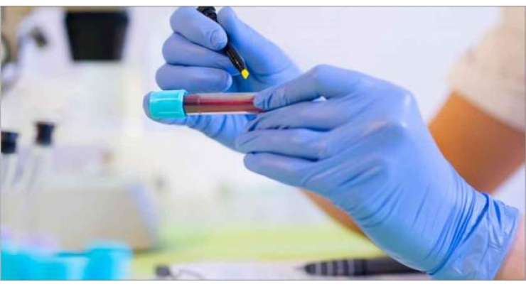 ملک بھر میں24 گھنٹوں کے دوران کورونا وائرس کے41ہزار240 ٹیسٹ کئے گئے ،وزارت قومی صحت
