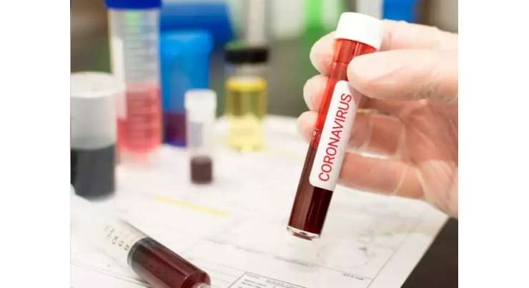 کورونا وبا سے متاثرہ مزید 36 افراد زندگی کی بازی ہار گئے ،ایک ہزار 392 نئے کیسز رپورٹ