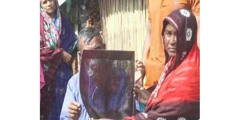 بنگلا دیش،خاتون کے پیٹ سے 20 سال بعد قینچیاں نکال لی گئیں