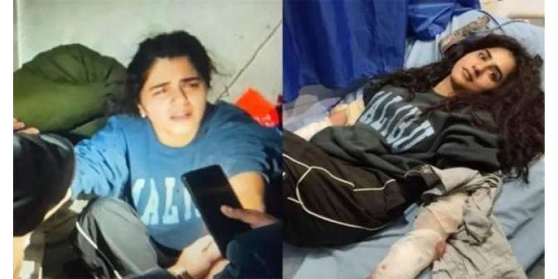 اسکردو میں ریچھ کے حملے سے زخمی ہونے کے بعد قرة العین بلوچ کی مداحوں ..