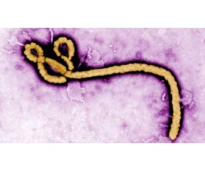 Ebola Virus Kiya Hai - Article No. 680