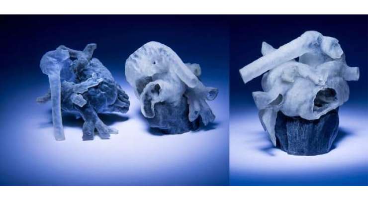MRI Scans Used To Create 3D Printed Hearts For Surgery Practice